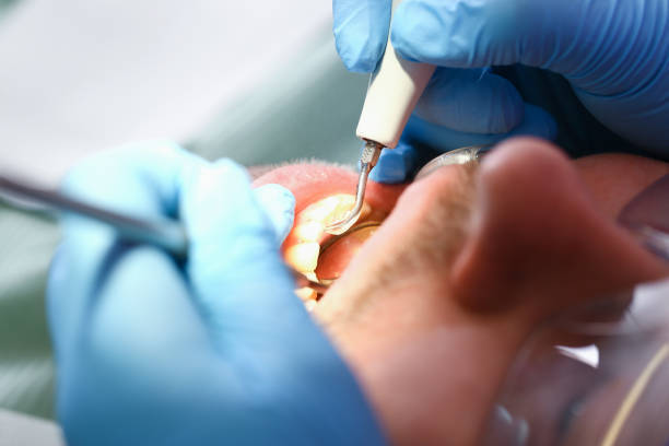 Best Emergency Tooth Extraction in University Gardens, NY